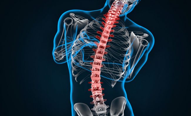 Hernias de la columna vertebral