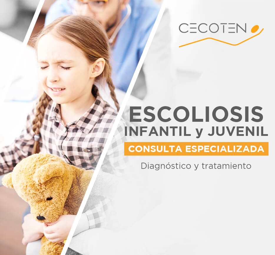 ESCOLIOSIS-INFANTIL