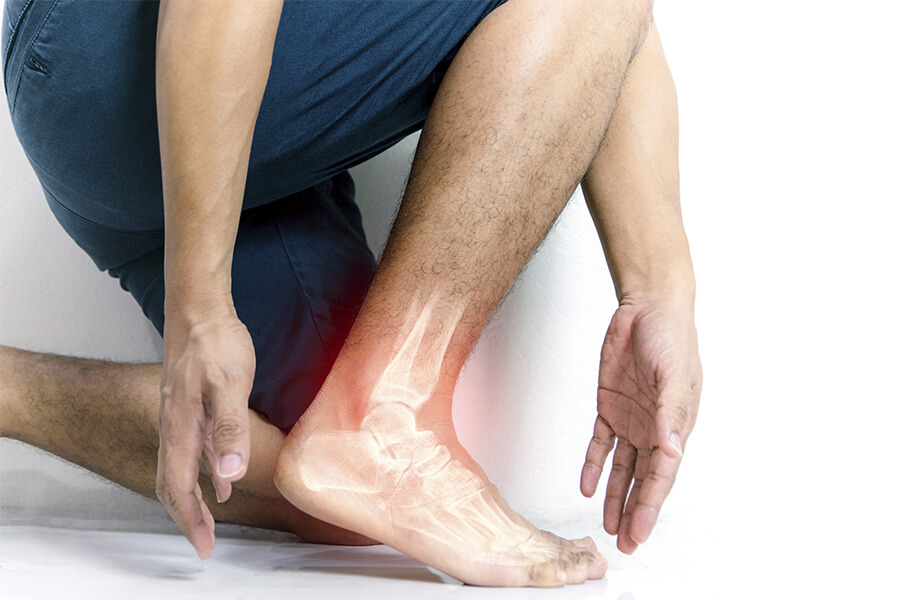 Lesiones de pie o o tobillo. ¿Cómo reconocerlas? ¿Cómo tratarlas?