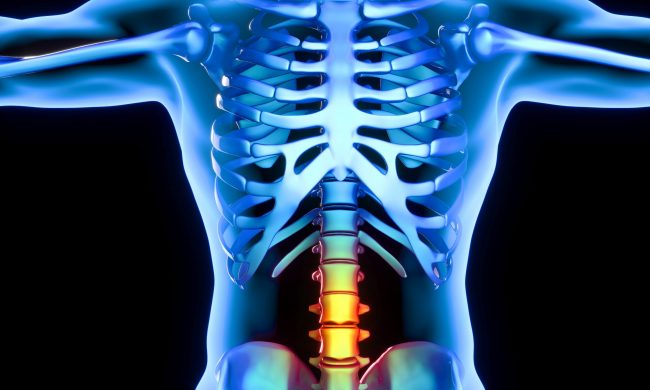 lumbar part of the vertebrae which present pain