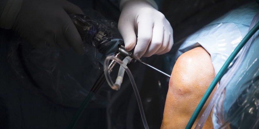 artroscopia cecoten tenerife