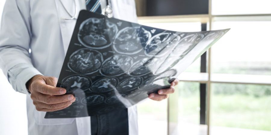 Neurocirujano de CECOTEN en intervención quirúrgica avanzada