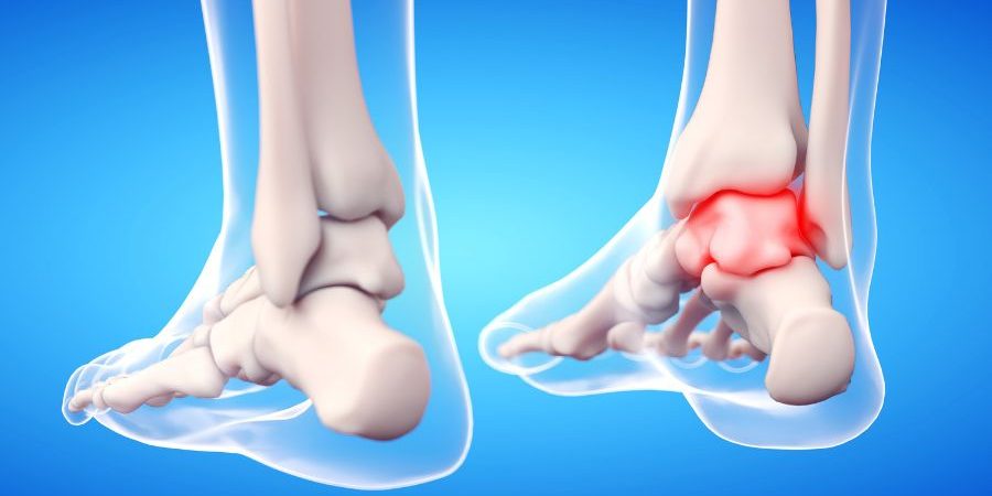 traumatólogo de pie y tobillo en Tenerife