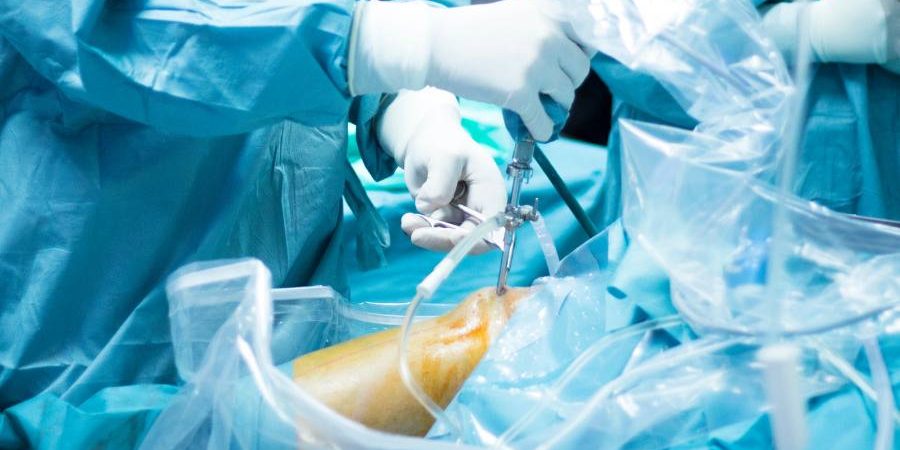 Paciente en recuperación tras una artroscopia con asistencia de fisioterapia en CECOTEN