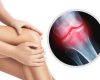 artrosis