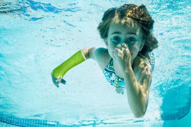 Yeso waterproof infantil resistente al agua alternativa a la escayola tradicional