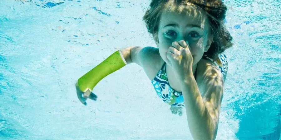 Yeso waterproof infantil resistente al agua alternativa a la escayola tradicional