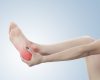 Paciente con dolor en el talón al levantarse durante valoración de fascitis plantar en CECOTEN
